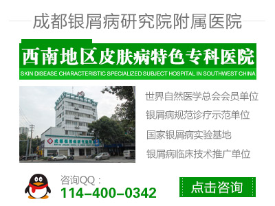 成都治银屑病效果好的医院