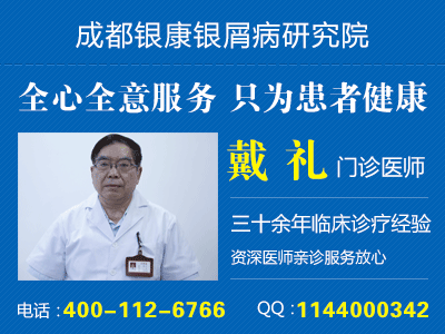 成都银屑病治疗 成都银屑病治疗