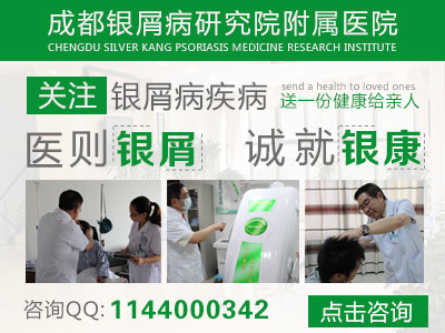 成都银屑病研究院牛皮癣能治好吗 成都银屑病研究院牛皮癣能治好吗