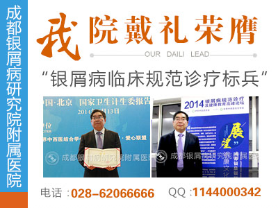 如何正确诊断牛皮癣 如何正确诊断牛皮癣