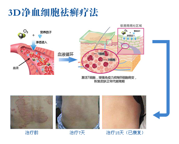 <a href=http://kmbdf.hynews.net/cdykyxb/ target=_blank class=infotextkey>成都银屑病研究院附属医院</a> 成都银屑病研究院地址