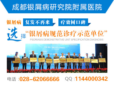 银屑病症状表现有哪些 银屑病症状表现有哪些