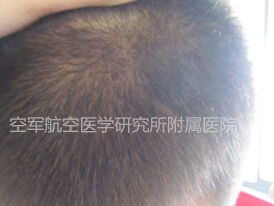 b37c720bcb5cb49fd2eda4ac988b0bc6.jpg