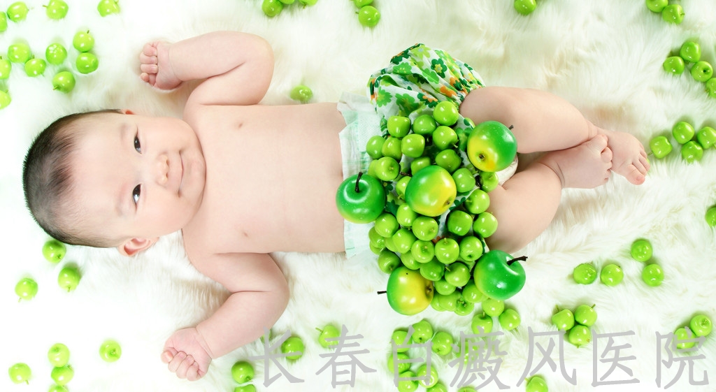 婴儿患白癜风怎么办