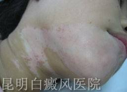 ʲôԭ����������