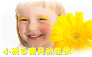 白癜风诊断依据有什么 白癜风诊断依据有什么