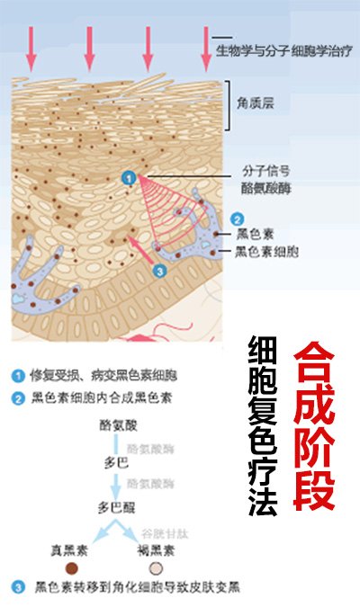 “细胞复色”疗法核心诠释