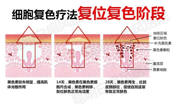 “细胞复色”疗法核心诠释