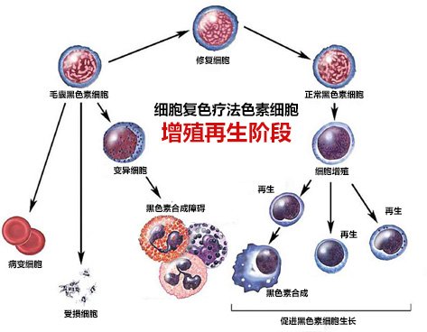 “细胞复色”疗法核心诠释