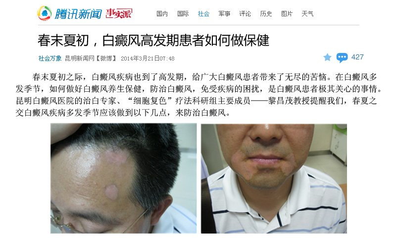 腾讯网:春末夏初,白癜风高发期患者如何做保健