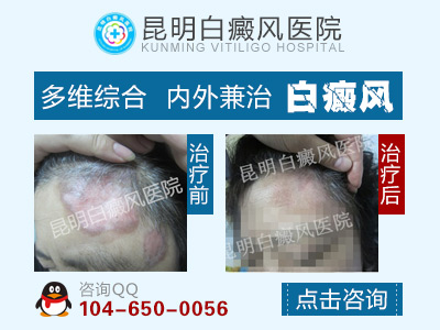 �����ļ�ҽԺ���ư���Ч����