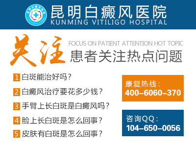 昆明哪家医院做白癜风黑色素种植效果好