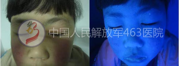 沿Ͱ
