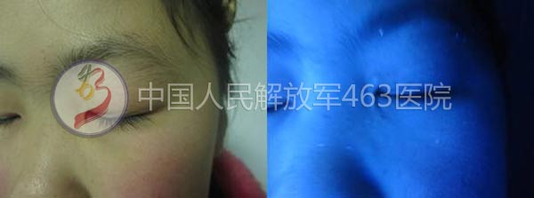 沿Ͱ