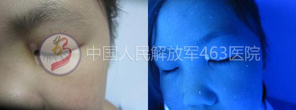 沿Ͱ